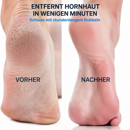 PureHaut Cleanfeet Hornhautfeile