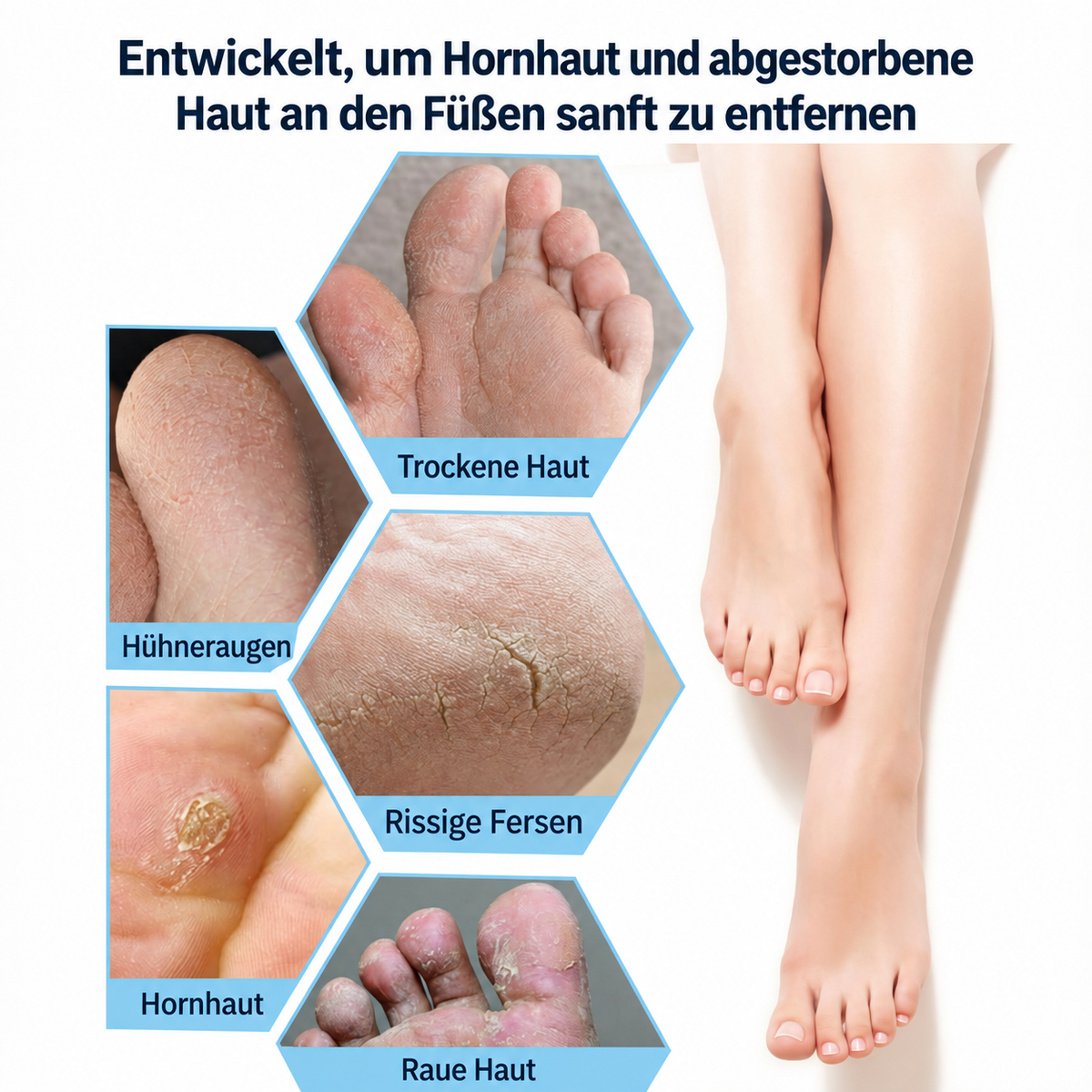 PureHaut Cleanfeet Hornhautfeile