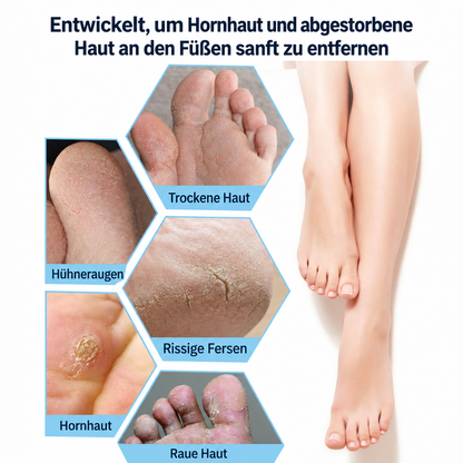PureHaut Cleanfeet Hornhautfeile